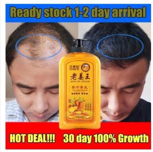 【new】ORIGINAL  King of Ginger Hair Shampoo Fast Regrowth Hair Thick Anti-Hair Loss Anti-Dandruff Anti-itching