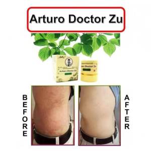 Skin Herbal Psoriasis Dermatitis Eczema Pruritus Psoriasis Cream Ointment 7g doctor Zu 5show