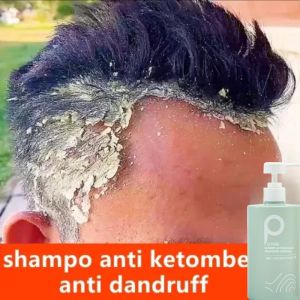 LIFUSHAShampo anti ketombe Shampo rambut rontok mite removal Shampo penumbuh rambut cepat Jahe ketombe / oil control 500ml