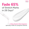 Mama’s Choice Stretch Mark Treatment Series | Stretch Mark Cream and Serum | No Paraben and Alcohol. 
