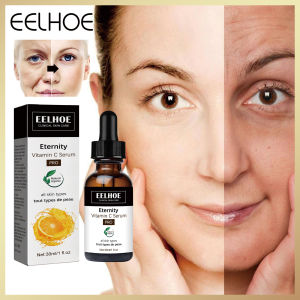 Eelhoe Vitamin C Huyết Thanh Tinh Chất Sửa Chữa Đa Tác làm săn chắc da chống lão hóa ngừa nếp nhăn Tinh Chất Vitamin-C Huyết Thanh Chống Lão Hóa Chống Nhăn Mất dần Nếp Nhăn Làn Da Trẻ Hóa Tinh Chất Dưỡng Da Chăm Sóc vải dầu Ngày Đêm