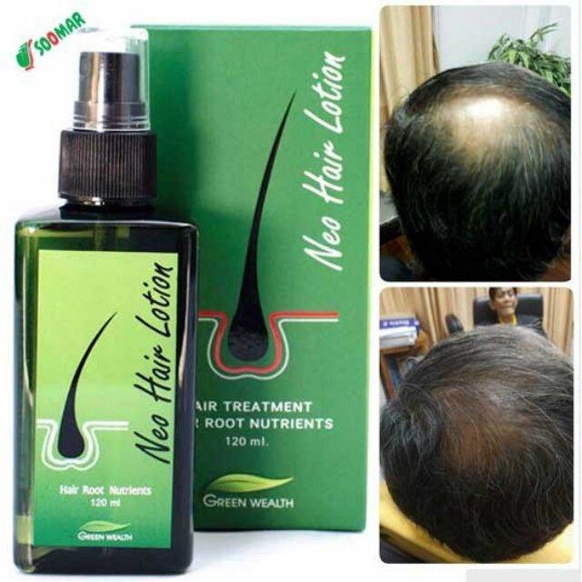 Neo Hair Lotion 100 Orignal Spray New Arrival Hair Transplant And Hair Loss Treatment Gmp 4098