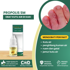 Obat Kutu Air Pada Kaki Penghilang Kuman Air Obat Kutu Air Ruam Dan Gatal Obat Jamur Kutu Air Obat Kutu Air Di Telapak Kaki - Propolis SM