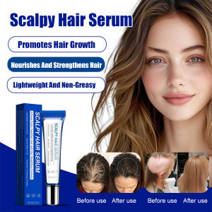🔥 Super Low Price🔥Scalp Care Hair Serum Scalp Treatment Essence For Hair Growth Nourishes Hair Follicles Reduces Hair Loss Natural Hair Tonic For Men And Women Natural Formula Reduces Hair Loss Scalp Essence Nourishes Hair Follicles Treatment