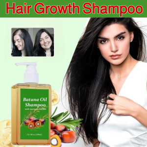 【Rapid Hair Growth In 7 Days!】Hair Growth Shampoo Anti-hair Loss Shampoo Oil Control Refreshing Moisturizing Nutrition
