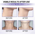 EELHOE Neck Firming Cream Wrinkle Remover Rejuvenation Fade Fine Lines Double Chin Reducer Anti Aging Tightening Collagen Neck Cream Neck Firming Wrinkle Remover Cream Rejuvenation Firming Skin Whitening Moisturizing Shape Beauty Neck Skin Care Products. 