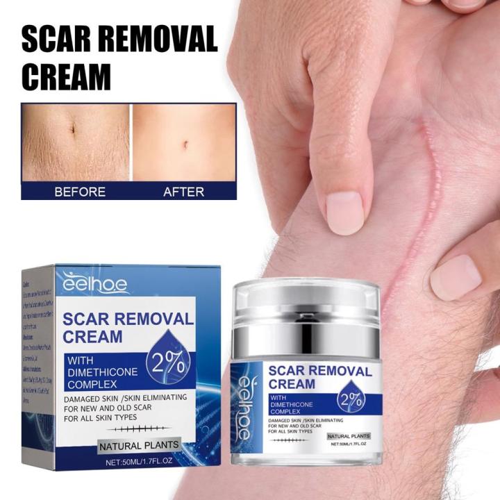 Effective Scar Removal Cream Scar Gel Old Scars Stretch Marks Treatment ...