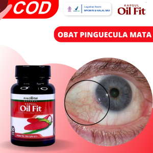 Obat Pinguecula Mata Obat Benjolan Bitik Kuning Di Mata Obat Penghilang Benjolan Di Bola Mata Obat Benjolan Kuning Di Sudut Mata Mata Kuning Menonjol Obat Selaput Bening/Lemak Mata Dengan Oil Fit