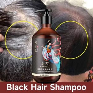 Perawatan Rambut Rontok Ketombe Dan Uban-polygonum Multiflorum Shampoo 300ml