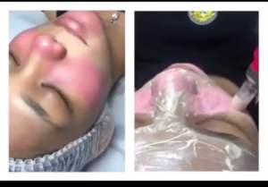 XY BB GLOW - XY Mesowhite Korea