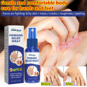 South Moon Psoriasis Soothing Spray Skin Soothing Mist Itch Relief Body Mist Moisturizing Daily Care Spray