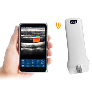192 Element Wireless Ultrasound Scanner Color Doppler WiFi Ultrasound Scanner for MSK/Superficial Vessels/Anesthesia