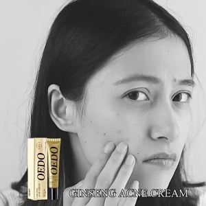 OEDO Plant Extraction Repair Acne Cream Ginseng Scutellariae Extract Face Care Ance Treatment whitening Skin Care
