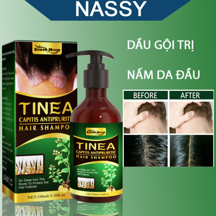 Dầu gội nấm da đầu dược liệu Tinea chống ngứa giảm gàu, rụng tóc và nấm ngứa da đầu - 100ml