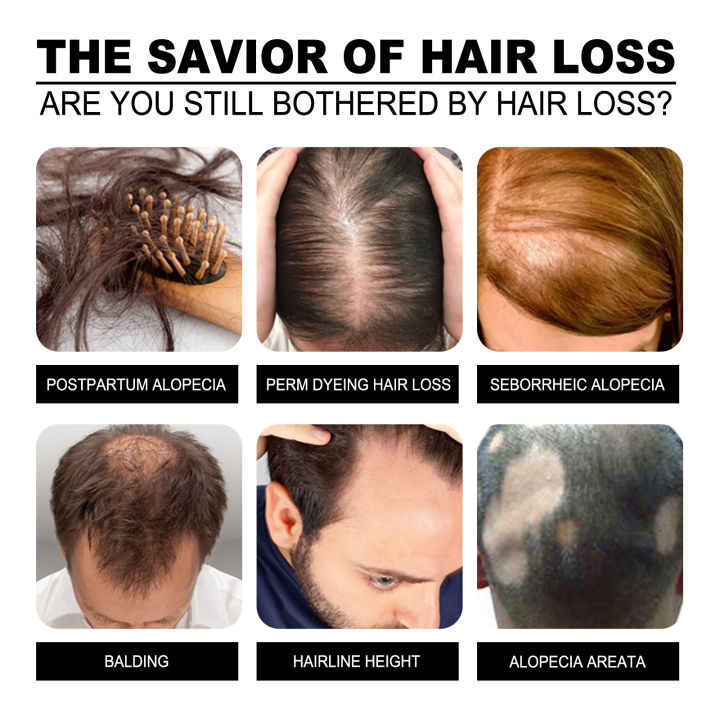 South%20Moon%20Essential%20Oil%20Original%20Authentic%20Essence%20Peptide%20Beard%20Regrowth%20Serum%20Thinning%20Treatment%20Growth%20Liquid%20Anti-Hair%20Loss%20Hair%20Care%20Product(30ml)%20-%20Image%205