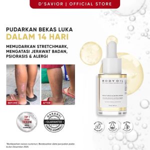 Dsavior Body Oil 30ml Penghilang Bekas Luka Eksim Psioriasis Stretchmark Gatal Alergi D savior D’SAVIOR bio oil JerawaT tUBUH