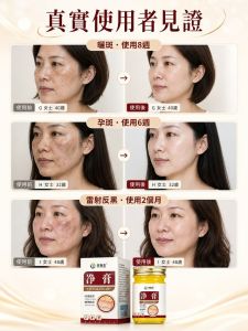 Spotless Cream Plant Essence Dark Spot Remover Face Cream Herbal Formula Women Skincare Night Routine/Reduce Pigmentation/Anti-Blemish