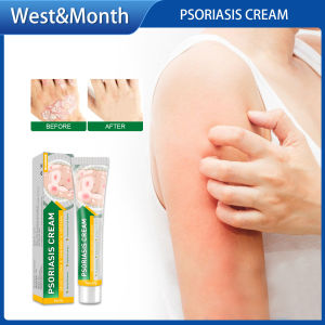 West Month Psoriasis Cream Bacteriostasis Antipruritic and Skin Repair Cream Relieve Psoriasis Dermatitis Eczema Pruritus Dermatitis Eczematoid Eczema Ointment Treatment Psoriasis Skin Care Cream(20g)