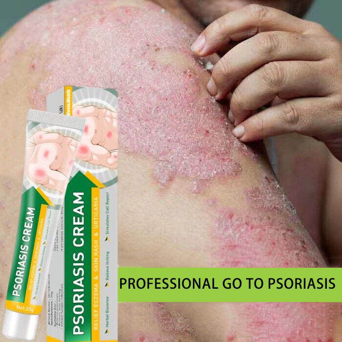 Psoriasis Cream Eczema Psoriasis Hand and Foot Ringworm Sweating Herpes ...