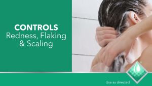 【Flash Sale】Nizoral Shampoo Anti-Dandruff Shampoo Scalp Care Itchy Flaky Hair Treatment 60ML