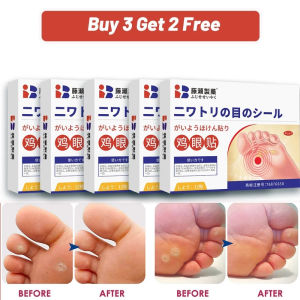 Fast Shipping Japan Wart Removal Patch Foot Corn Remover Corn Plaster Removal of Warts on Hands and Feet Skin Tag 鸡眼贴/足部护理贴  Cod