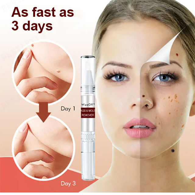 H Wart Removal Liquid Pen/Mole removal care pen 3ml