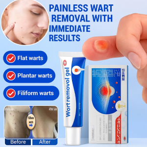 Fast Acting Wart Removal Gel Body Warts Treatment Cream Blemish Removal Gel Painless Treatment for Flat Warts Skin Tags Moles