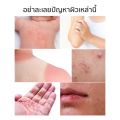 Real Derma - Medical Cream MD ครีมรักษาผิวแห้ง ผิวอักเสบ รอยแผลเป็น 50g. 