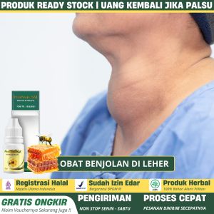PROPOLIS SM 100% ASLI Obat Benjolan di Leher Anak dan Dewasa Obat Kelenjar Getah Bening Kelenjar Tiroid Obat Gondok