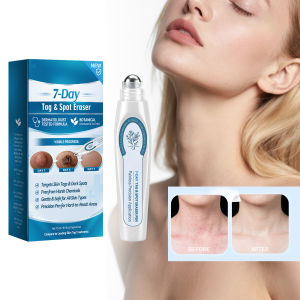 AMZ Skin Care Rollerball Pen 15ml Helps Target Local Skin Concerns Supports Smooth Skin Texture For Men Women Precision Application Non Sticky For Face Neck Body Daily Skincare Dark Spot Corrector Pen