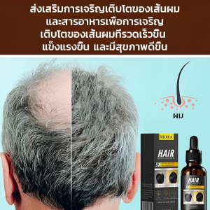 มองเห็นได้ การเติบโตอย่างรวดเร็ว เส้นผม ป้องกันผมร่วง การดูแลเส้นผม ผลกระทบ