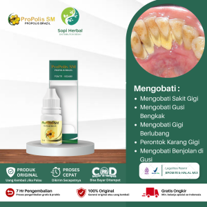 Obat Pemutih Gigi - Penghilang Plak Karang Gigi - Pembersih Gigi - Mengangkat Karang Gigi - Penghilang Karang Gigi Permanen - Memutihkan Gigi - Mencegah Gigi Kuning - Pembersih Plak Gigi Secara Permanen - Propolis SM