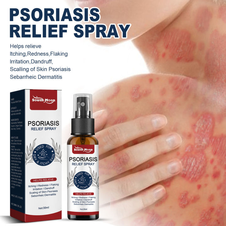 South Moon psoriasis Eczema Ointment Psoriasis Treatment Cream gamot sa ...