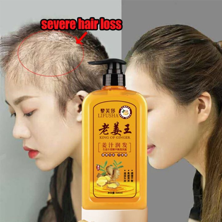 500ml Ginger Hair Shampoo Fast Regrowth Hair Thick Shampoo Anti Hair Loss Anti Dandruff Anti 8902