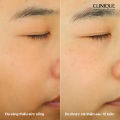 Serum dưỡng sáng da Even Better Clinical™ Dark Spot Clearing 30ml, 50ml, 75ml l làm sáng da, giảm đốm nâu, cải thiện da bị xỉn màu và vàng da. 