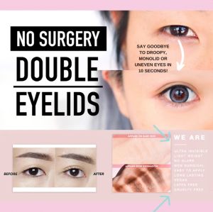 Luxe Eyes Fiber Lace Eyelid Lace Lift Kit (Natural Shape)