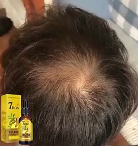 Hair Growth Serum 50ml Treatment For Hair Loss And Prevention Of Baldness Pampakapal Ng Buhok