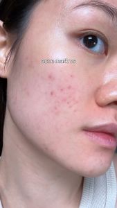 Tinh Chất Numbuzin No.5+ Vitamin Concentrated Serum 30ml  Chống Lão Hoá Dưỡng sáng