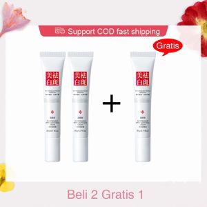 Whitening Freckle Cream Remove Dark Spots Anti Freckle Cream Niacinamide Fade Pigmentation Melasma Brighten Creams 20g