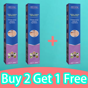 Wart remover ubat ketuat skin tag remover Ubat Ketuat & Skin Tag Remover cream kutil removal ubat kutil tahi lalat ketuat dan biji kolesterol