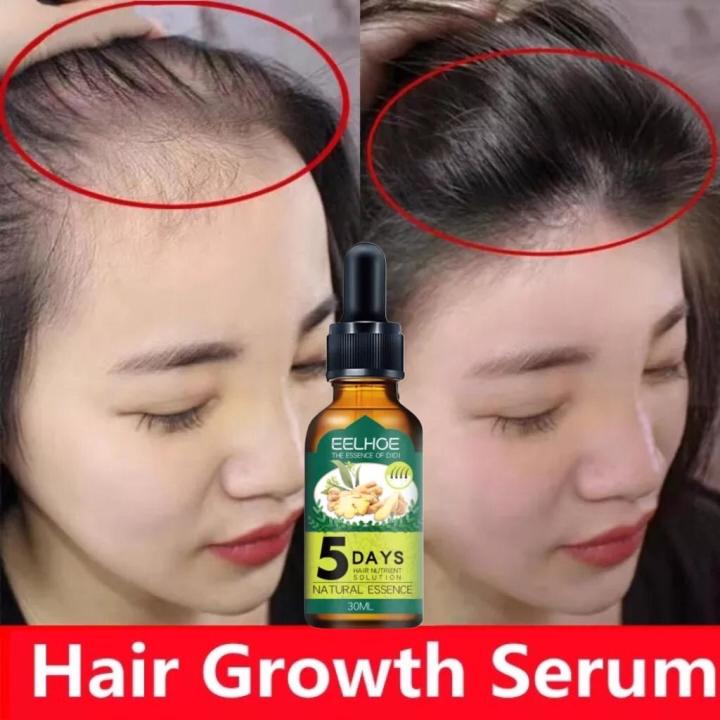 C10 EELHOE Hair Growth Serum Penumbuh Rambut Wanita Pria Secara Cepat c10-eelhoe-hair-growth-serum-penumbuh-rambut-wanita-pria-secara-cepat