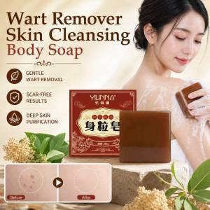 Anti-Wart Skin Cleansing Soap Gentle Formula for Clear Skin