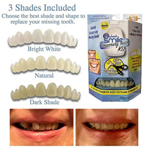 Instant Smile Temporary Tooth Kit 3 Warna Gigi Palsu x 10 Pcs + Bahan Pemasangan 1.5 Gr