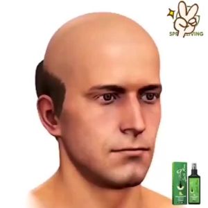 Ginger hair growth spray herbal essence hair treatment hair tonic growth ubat lebatkan rambut hairfall treatment