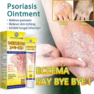 Eczema anti itch 10% Psoriasis Cream Sulfur antipruritic ointment 20g/box For Sensitive Skin Redness itching Private Part Itchy Quick itching relief