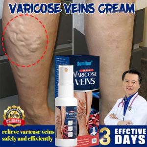 Varicose Veins Remover Spray Effective Relief From Painful Leg Veins Treatment spray 30ml Original
