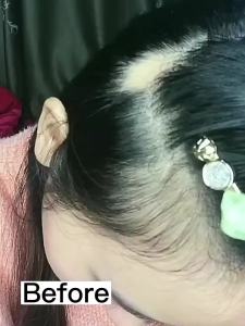 Onion Rosemary Spray 30ml Blackseed Hair Growth Mist Leave In Hair Growth Spray For Longer Thicker Fuller Hair Loss Hair