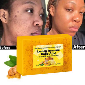 100g Natural Turmeric Whitening Body Wash Soap Deeply Clean Remove Dark Spot Pimple For Face & Body