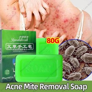 Wormwood Soap Mite Acne Soap Anti Itching Anti Fungus Whitening Psoriasis Sulfur Antibacterial Soap 80g