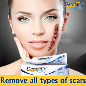 Original DERMATIX Ultra advance scar Remover gel 15g dermatix Ultra Scar Remover for old scar on leg peklat remover for legs peklat remover cream for old peklat soap for kids repair surgical acne scar for accident burn let skin re-grow and regeneration